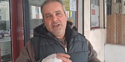 Başıboş pitbull, köpeği parçaladı, 1 kişi de yaralandı: Dehşet anları kamerada